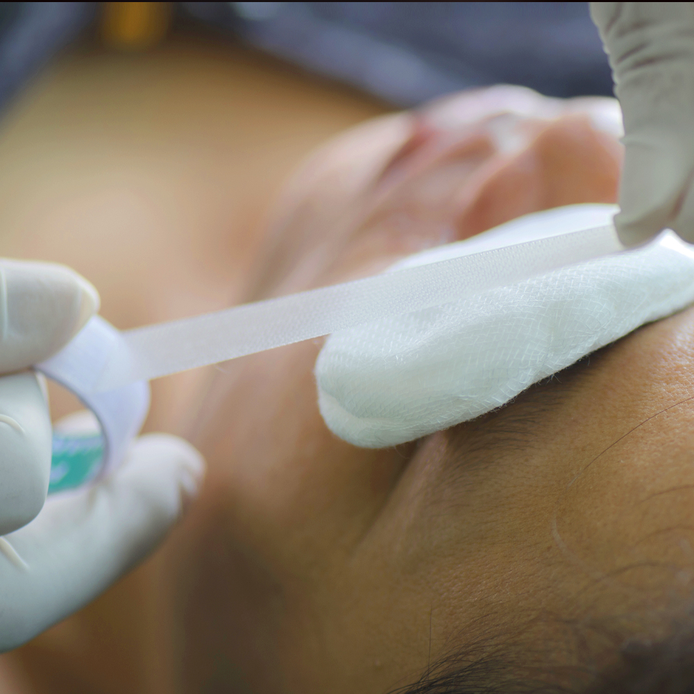 eye emergency treated at Alvernon Optical - Campbell